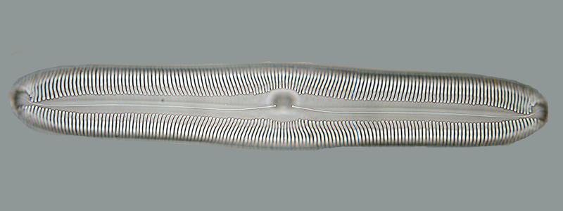 Pennate diatom in valve view