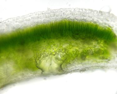 Cross section of a leaf of Nerium oleander showing stomatal crypt
