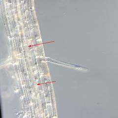 Grass seedling root - helical secondary wall thickenings of protoxylem vessel
