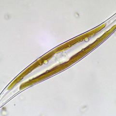 Diatoms - Gyrosigma, a pennate diatom