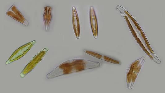 Some fresh water diatoms common to Wisconsin