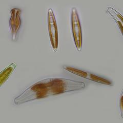 Some fresh water diatoms common to Wisconsin