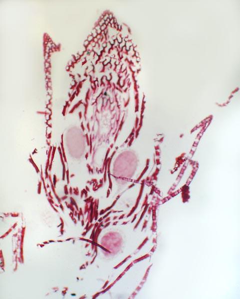 Longitudinal section of Sphagnum moss antheridium