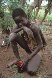Orphaned Boy with Meal