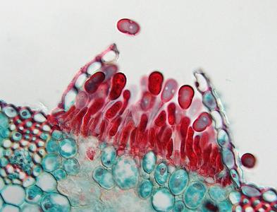Cross section of an infected leaf of wheat through an uredinium with urediniospores