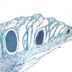 Marchantia - longitudinal section of antheridiophore - antheridia