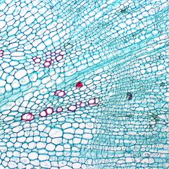 Rays and vascular cambium in a cross section of a carrot root