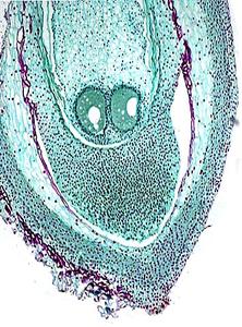 Longitudinal section of ovule with mature megagametophyte with two eggs visible