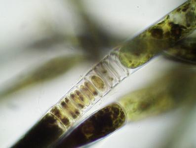 Oedogomium - antheridia stained with iodine