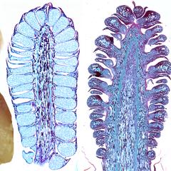 Composite of male and female pine cones with dissected microsporophylls on the left and seed scale complexes on the right