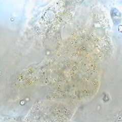 Plasmodial slime mold movie - cytoplasmic steaming of plasmodium 100x objective
