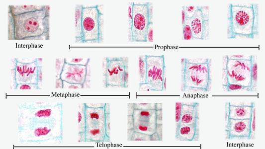 Composite of all stages of mitosis in onion root tip - labeled