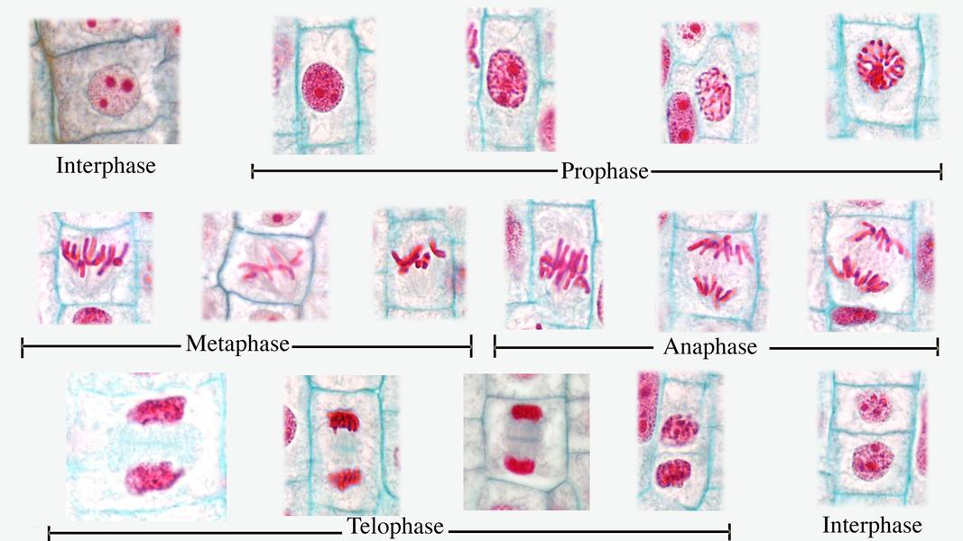 ‎Composite of all stages of mitosis in onion root tip - labeled - UWDC ...