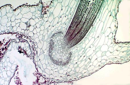 Foot of the a sporophyte embedded in gametophytic tissue of a hornwort