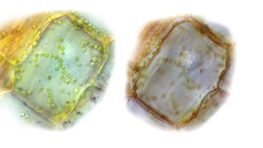 Two views of the same cell of Elodea with the plane of focus in different positions