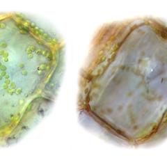 Two views of the same cell of Elodea with the plane of focus in different positions