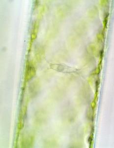 Spirogyra - nucleus