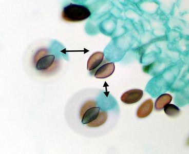 Coprinus mushroom cross section through gills - through-focused basidium