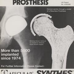 Wagner Resurface Prosthesis advertisement