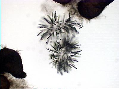 Intrastrain parathecium of Sordaria crushed to expose the asci with only black ascospores