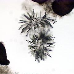 Intrastrain parathecium of Sordaria crushed to expose the asci with only black ascospores