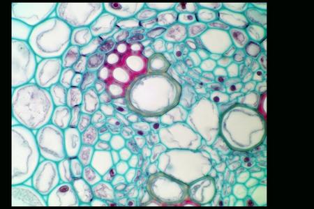 Casparian strips of endodermis seen in cross section of a immature Ranunculus root