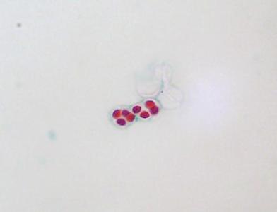 Ascus and ascospores of yeast - 100x objective