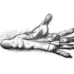 Main postérieure du malbrouck (Malbrouck foot)