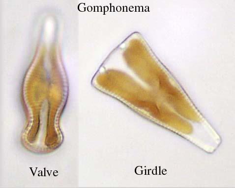 Valve and girdle views of Gomphonema, a pennate diatom - UWDC - UW