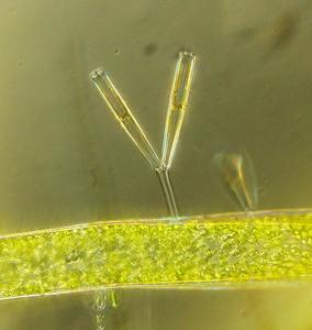Stalked-attached pennate diatoms