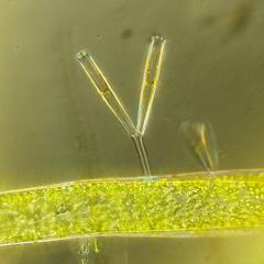 Stalked-attached pennate diatoms