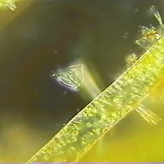 Movie of Vorticella showing cilia
