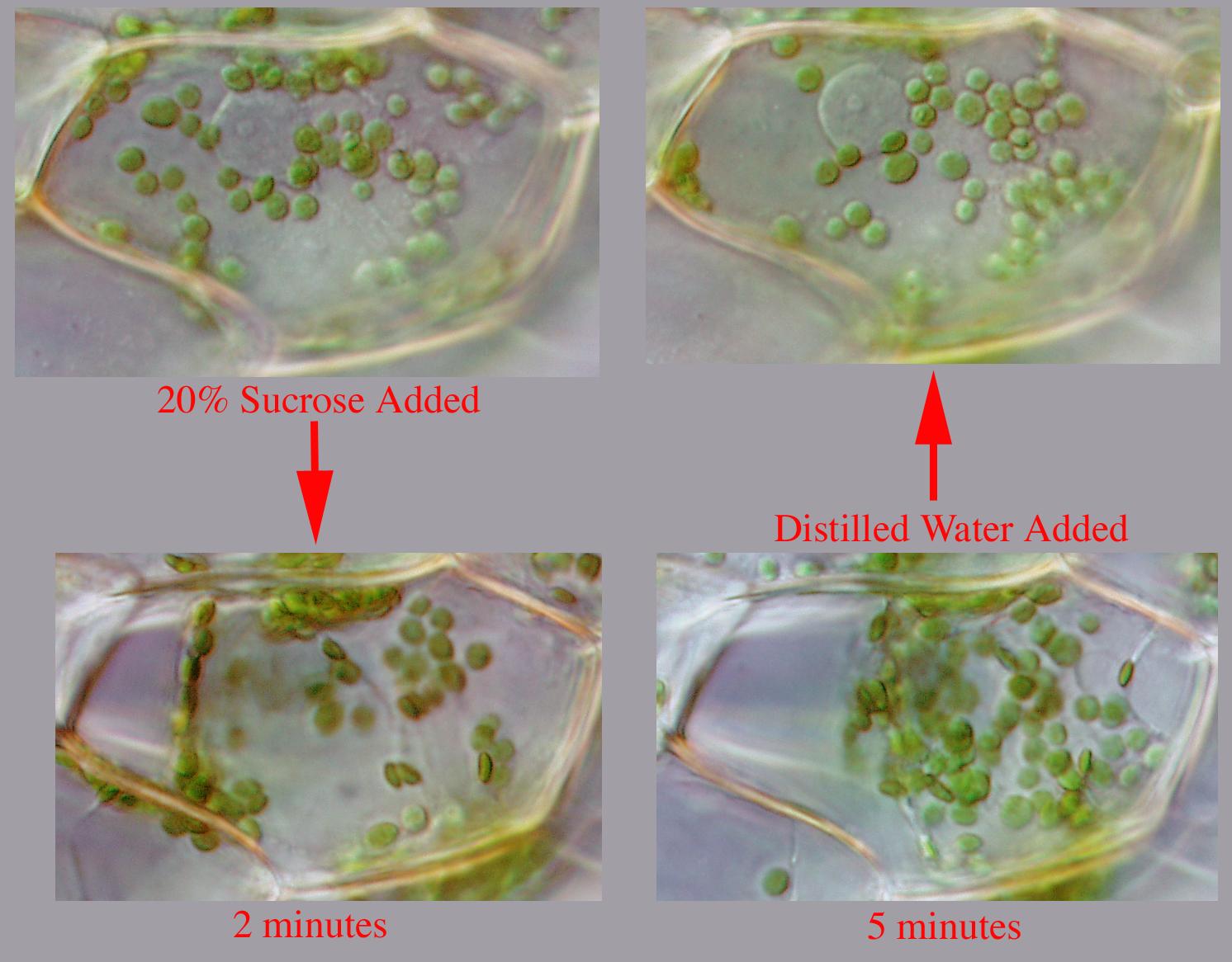 elodea cell under microscope