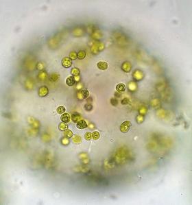 Eremosphaera - focus on chloroplasts below cell wall