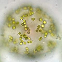 Eremosphaera - focus on chloroplasts below cell wall