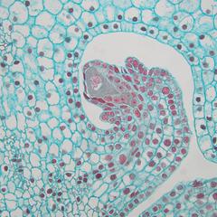 Ovule with megaspore mother cell of Lilium