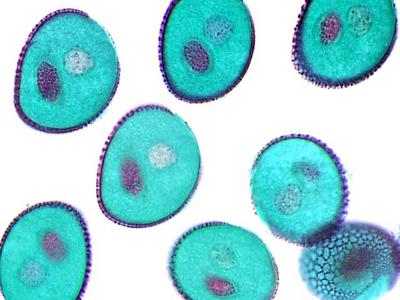 Pollen grains - Lilium microsporogenesis