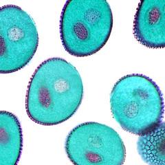 Pollen grains - Lilium microsporogenesis