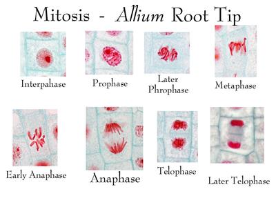 Composite of all stages of mitosis in onion root tip labeled
