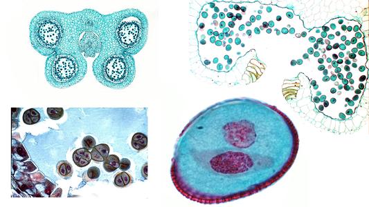 Lilium - composite of the androecium : cross section of young anther with tapetum, dehiscing anther, tetrad of microspores, two nucleated pollen grain ( microgametophyte )