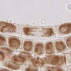 Anaphase from a Narcissus root squash