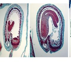Composite of four stages of embryogenesis in Capsella