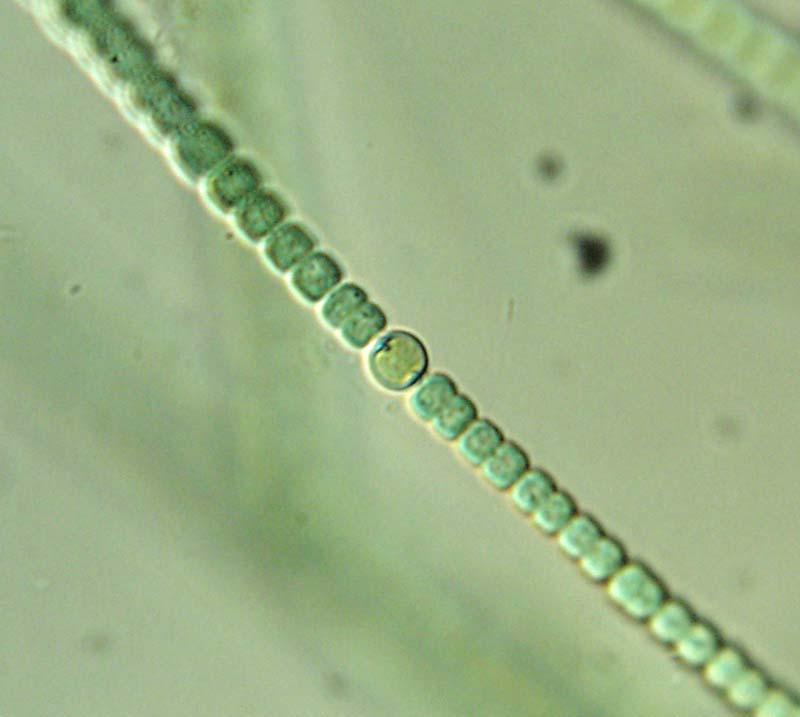 Клетки водорослей и цианобактерий. Цианобактерия Анабена. Синезеленые водоросли цианобактерии. Отдел цианобактерии сине-зеленые водоросли. Клетка цианобактерии Anabaena.