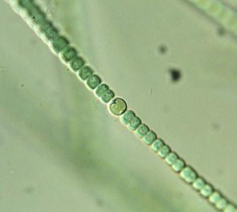 Anabaena filament with a heterocyst - 100x objective, DIC illumination