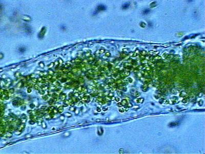 Hydrodictyon - zoospores contained in mother cell wall