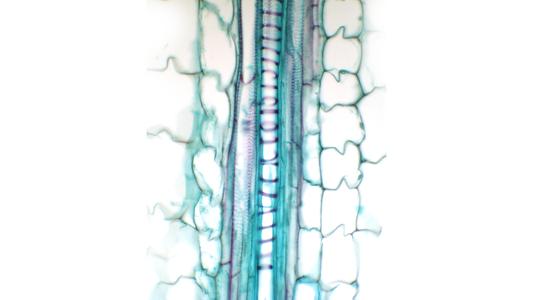 Protoxylem and metaxylem vessels in longitudinal section of Zea stem