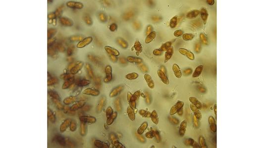 Cedar apple rust - teliospores from infection on cedar