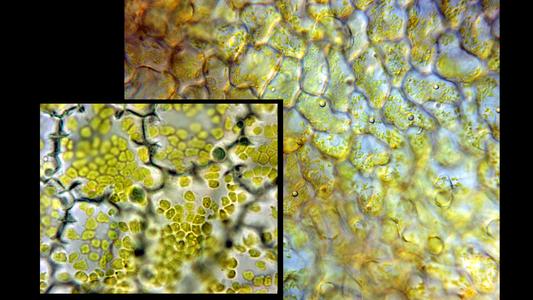 Allamanda flower petal cells showing chromoplasts through 100x and a 40x objectives