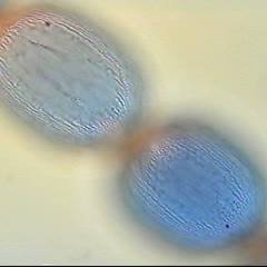 Through focused view revealing detail of a dynamic cells of Setcreasea.