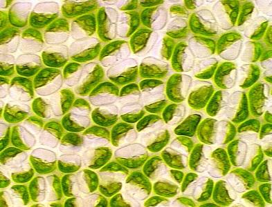 Ulva - cells with cup shaped chloroplasts and prominent pyrenoid